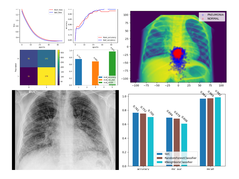 X-Ray Pneumonia Detection